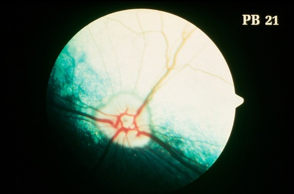 Canine eye: a normal fundus