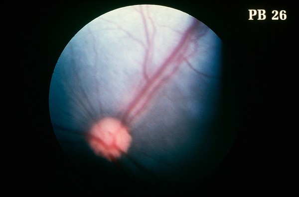 Canine eye: a normal fundus