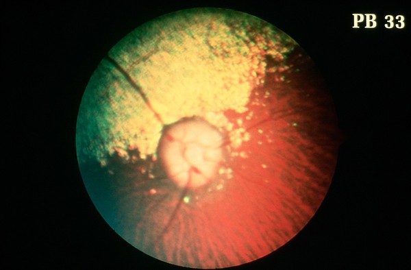 Canine eye: a normal fundus of a Miniature Poodle.