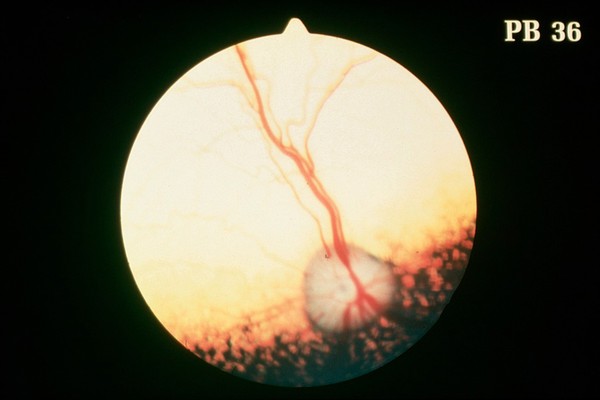 Canine eye: a normal fundus of a Miniature Poodle.