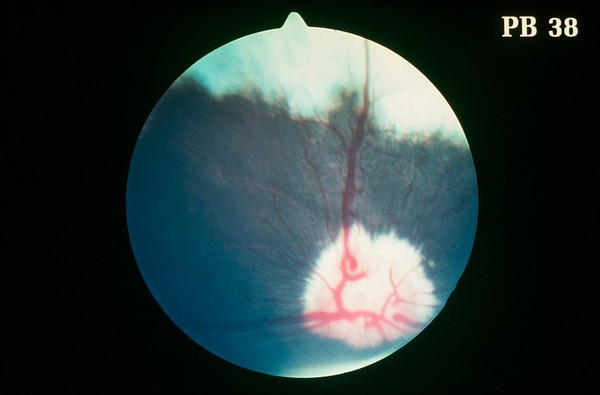 Canine eye: a normal fundus of a West Highland