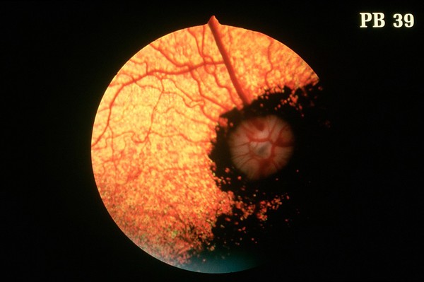 Canine eye: a normal fundus of a Toy Poodle.