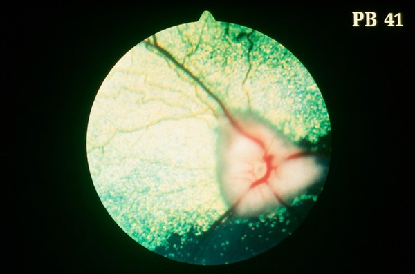 Canine eye: a normal fundus of a Golden Retriever.