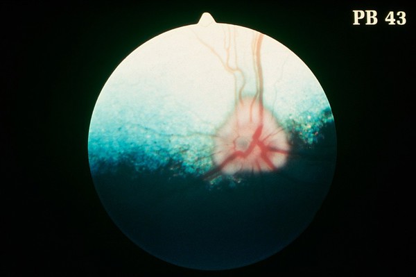 Canine eye: a normal fundus of an Elkhound.