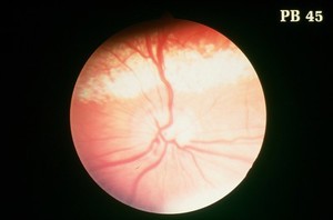 view Canine eye: a normal fundus of a Chihuahua.