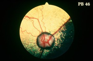 view Canine eye: a normal fundus of a Cocker Spaniel.