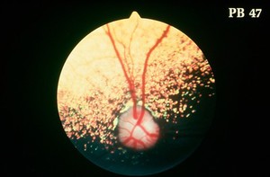 view Canine eye: a normal fundus of a Toy Poodle.