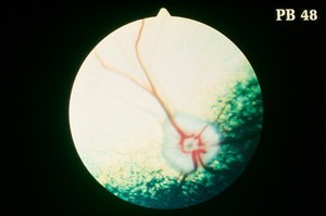view Canine eye: a normal fundus of a Wheaten Terrier.