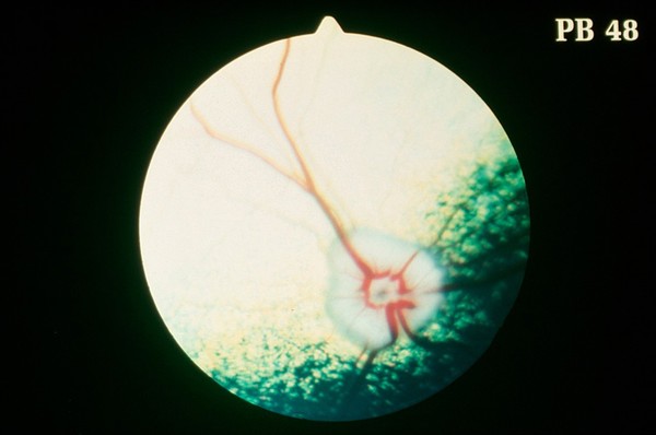 Canine eye: a normal fundus of a Wheaten Terrier.