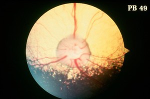 view Canine eye: a normal fundus of a Golden Retriever.