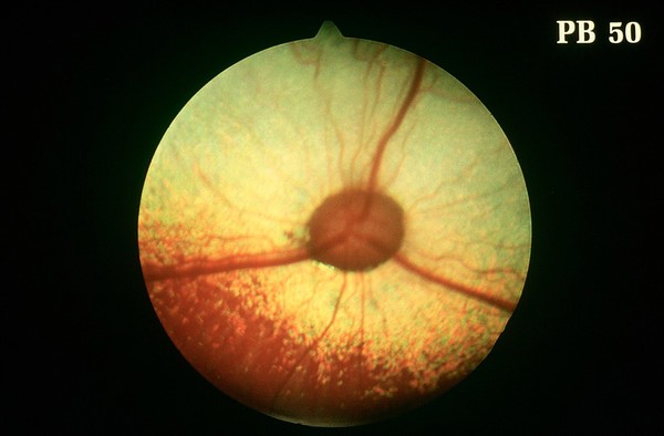 Canine eye: a normal fundus of a Springer Spaniel.