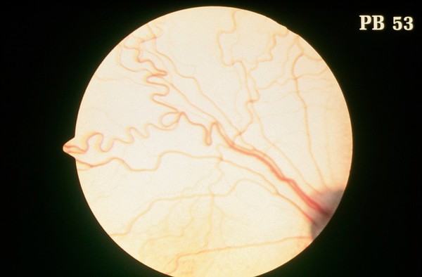 Canine eye: a normal fundus.