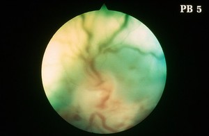 view Canine retina: acute inflammation of fundus