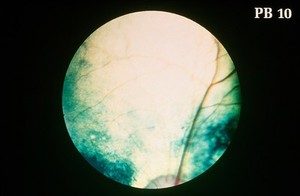 view Canine retinal degeneration