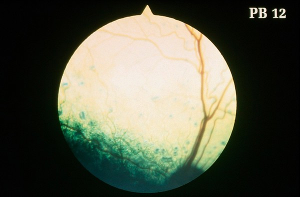 Canine retina: minimal retinal dysplasia