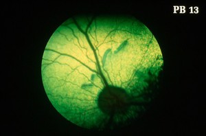 view Canine retina: dysplastic retinal tissue