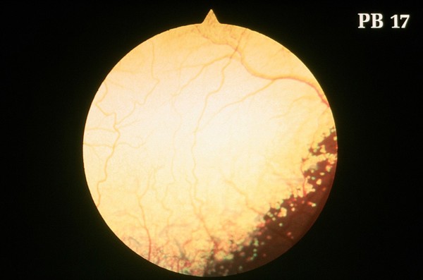 Canine retina: minimal retinal dysplasia