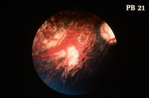 view Canine retina: choroidal hypoplasia