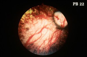 view Canine retina: choroidal hypoplasia