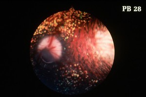 view Canine retina: typical papillary coloboma