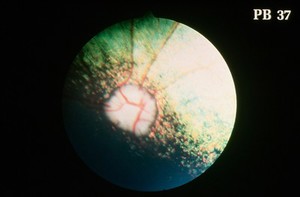 view Canine retina: early PRA