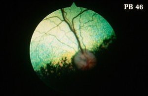 view Canine retina: normal right fundus