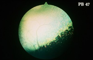 view Canine retina: normal tapetal fundus