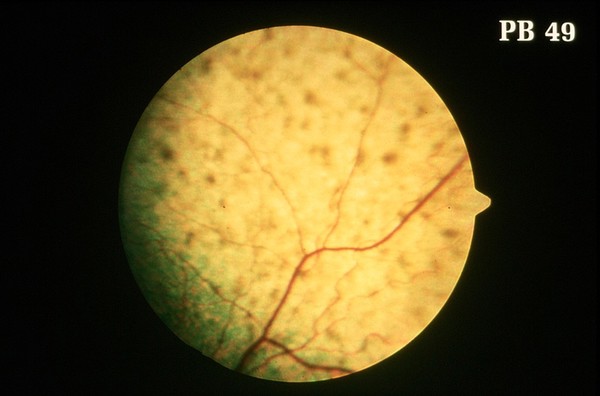 Canine retina: lipopigmentation in CPRA