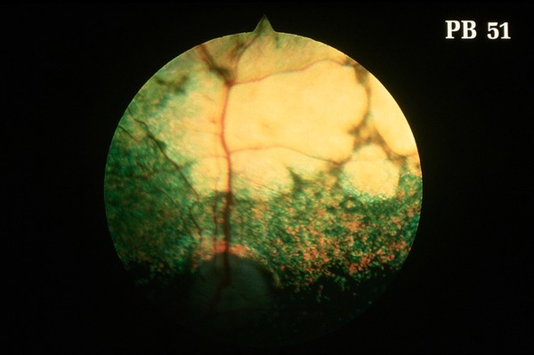 Canine retina: retinal degeneration in CPRA