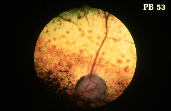 Canine retina: lipopigmentation in CPRA