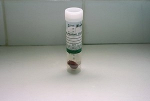 view Cat surgery, thyroidectomy