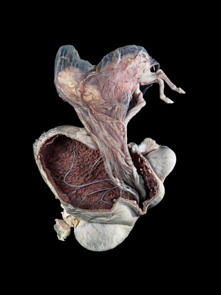 Photograph of a mare's (female horse) uterus with the fetus removed.