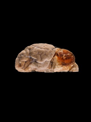 Tapeworm cyst in a sheep brain