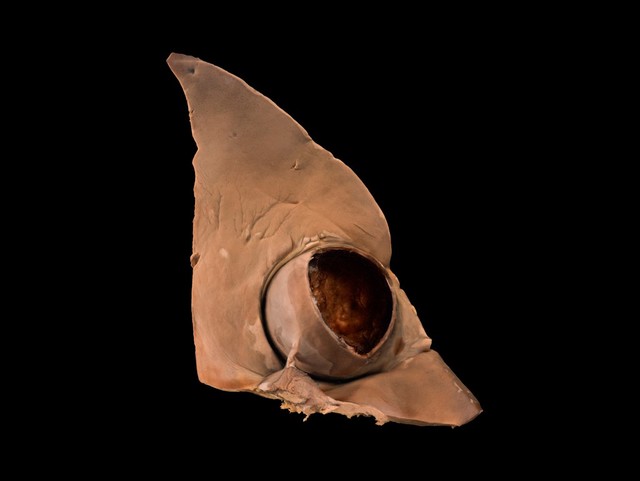 Hydatid cyst in a horse liver