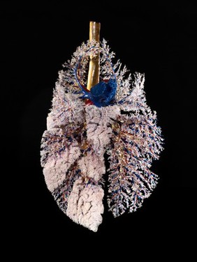 Corrosion cast of a pig's lung