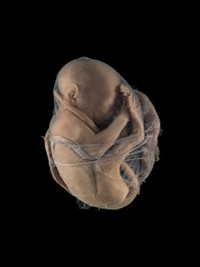 Fetus and discoid placenta, monkey