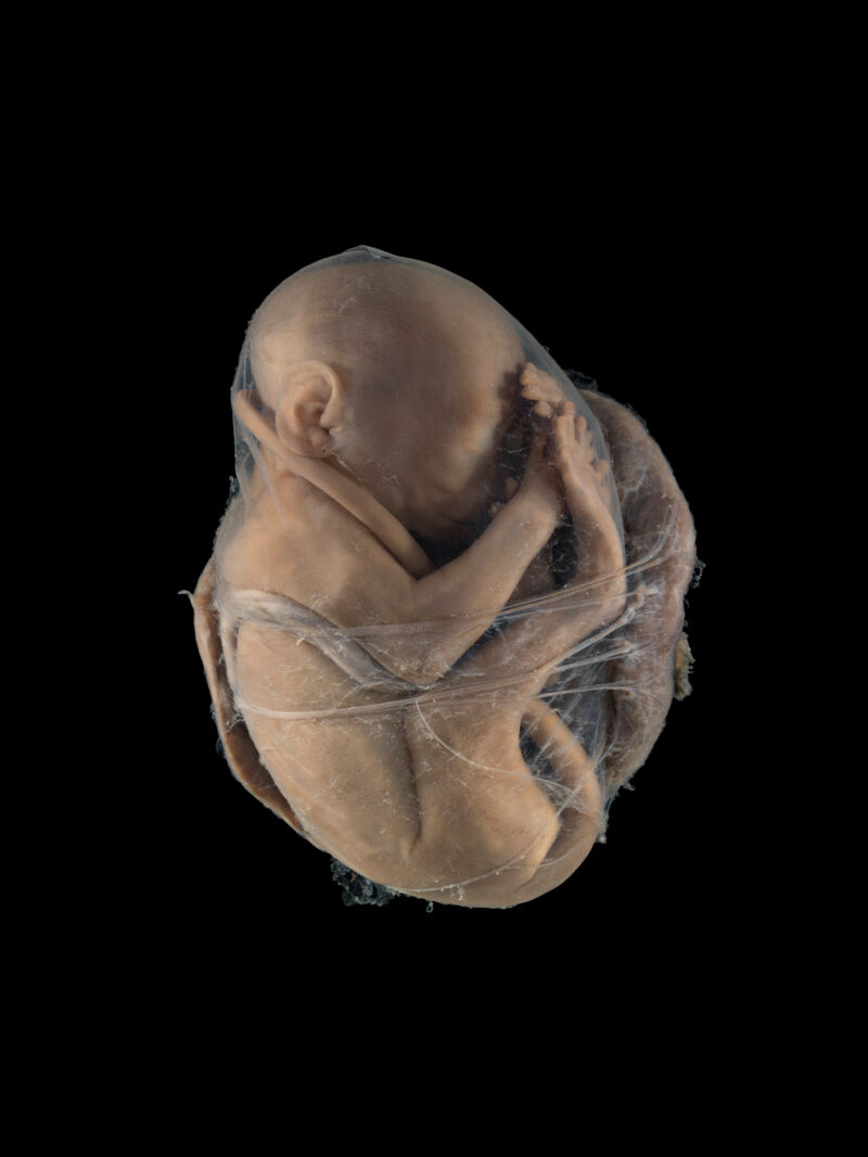 Fetus and discoid placenta, monkey | Wellcome Collection