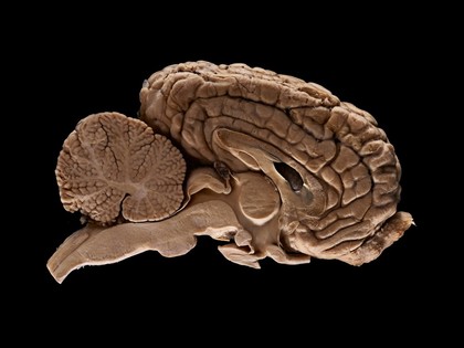 Adult horse (equine) brain, sagittal section