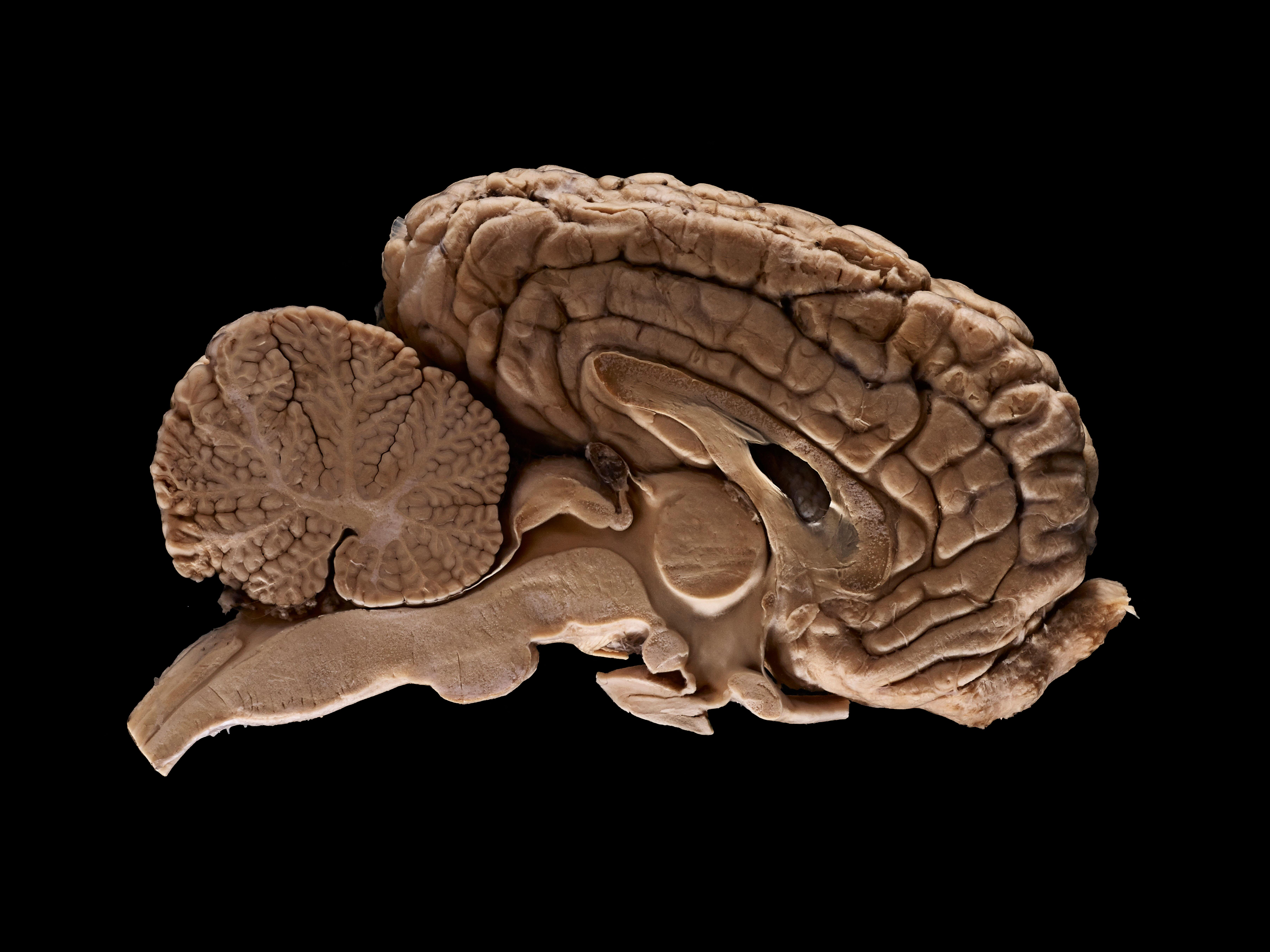 Adult horse (equine) brain, sagittal section | Wellcome ...