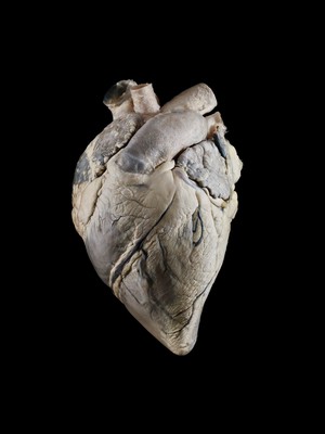 view Adult sheep (ovine) heart