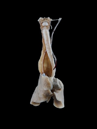 Persistent right aortic arch, canine