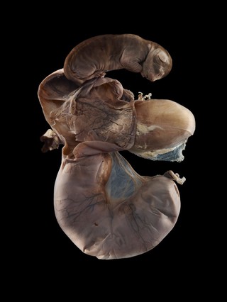 Canine pregnant uterus