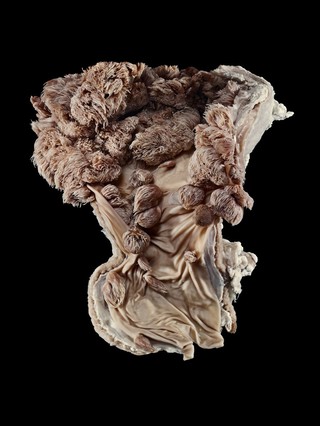 Cow foregut showing multiple warty growths (papillomas). These have grown from the gut lining, which is formed of squamous epithelium (consisting of flat, thin cells). These benign (non-cancerous) tumours can be caused by papillomavirus infection.