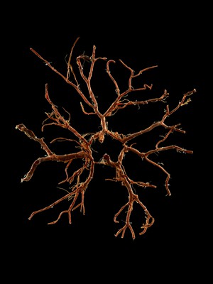 view Circle of Willis