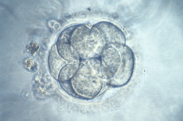 Human embryo from IVF | Wellcome Collection