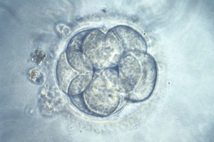 view Human embryo from IVF