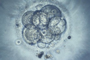 view Human embryo for IVF