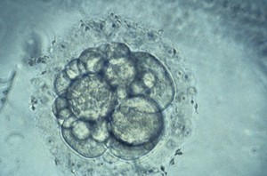 view Human embryo for IVF