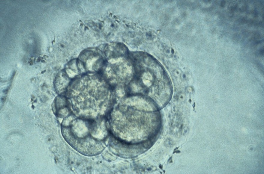 Human embryo for IVF