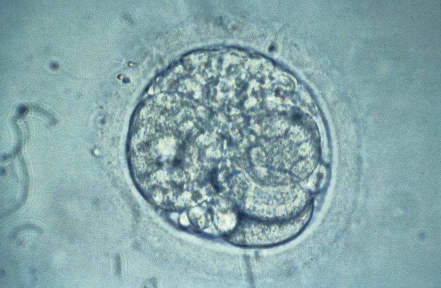 Human embryo for IVF